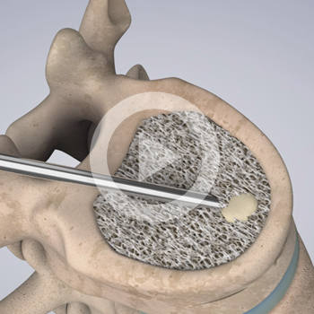 Animation médicale – Thiebaud